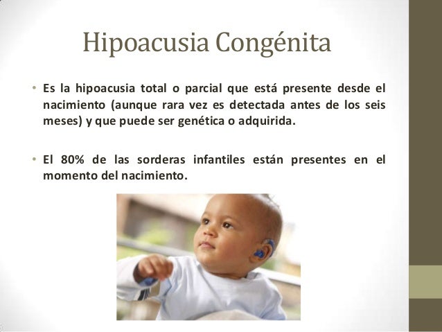 Image Result For Hipoacusia Image Result For Hipoacusia