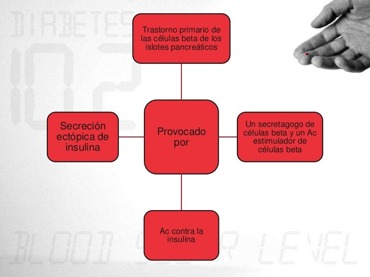 Hipoglucemia Hipoglucemia