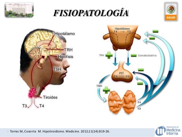 Non communicating hydrocele in adults
