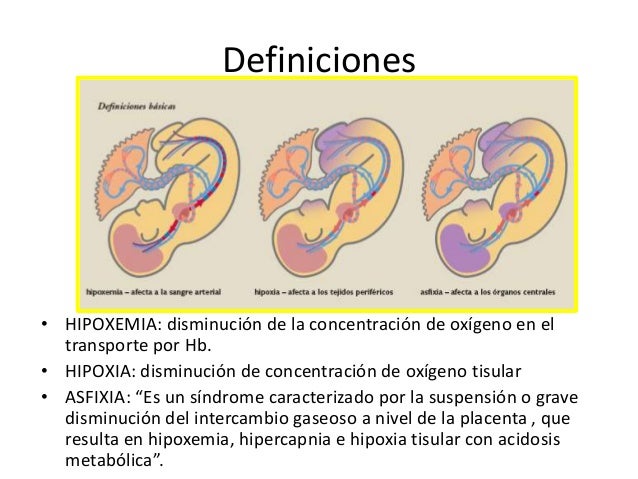 Hipoxia fetal y RCIU