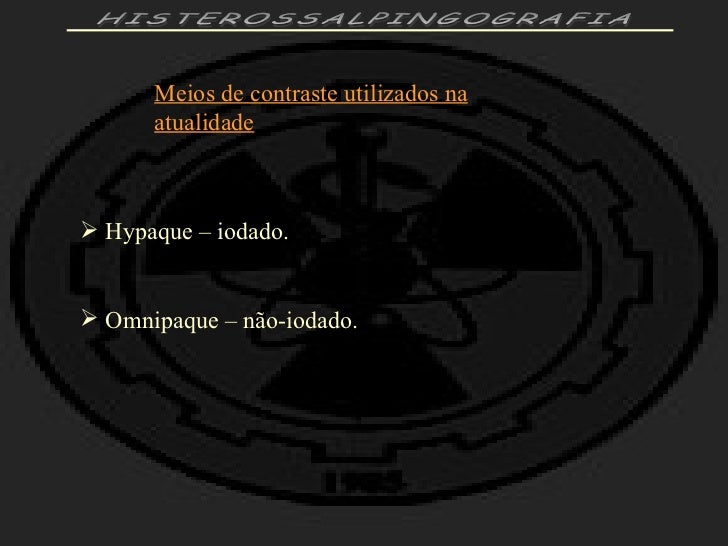 Exame histerossalpingografia preparo