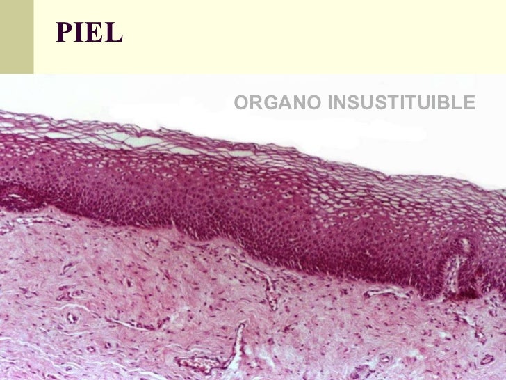 La psoriasis contra él la crema