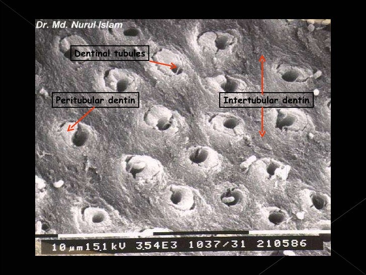 Histology of dentin
