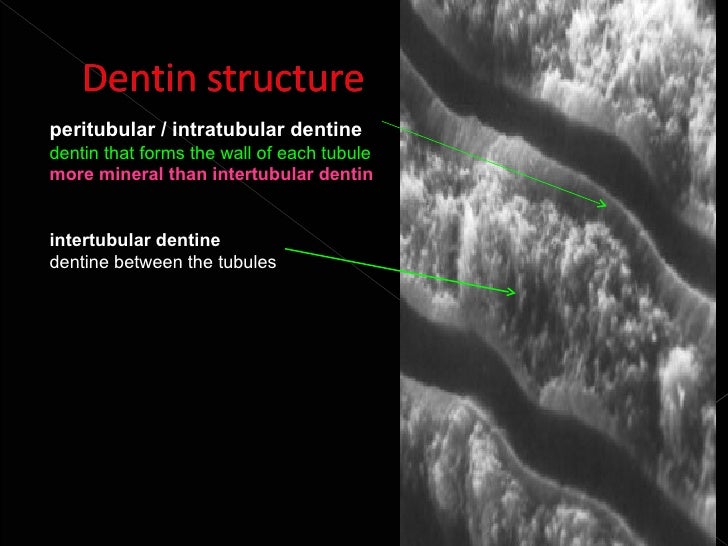 Histology of dentin