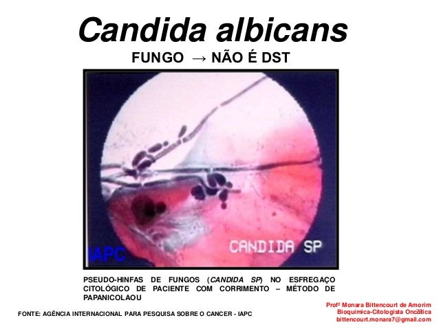 Foto de fungo em pele de pernas