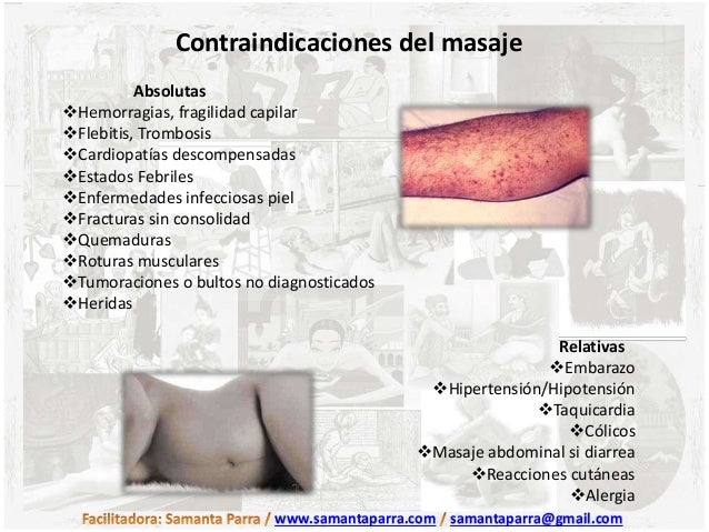 Flebologiya en el hospital mechnikova