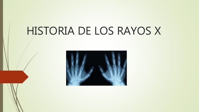 Historia de los rayos x
