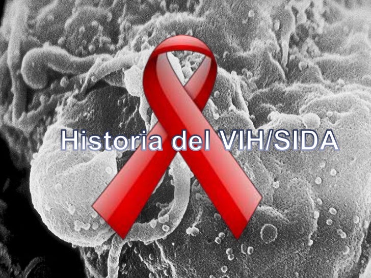 Historia Del V I H SIDA