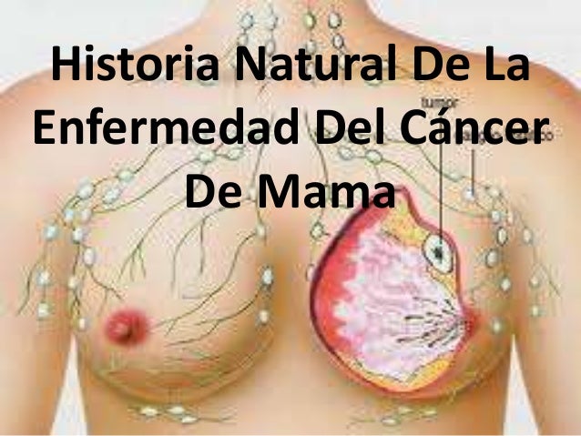 LA HISTORIA ER la historia er: