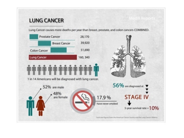 signs of long time asbestos exposure