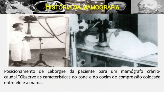 HIST RIA DA MAMOGRAFIA HIST RIA DA MAMOGRAFIA