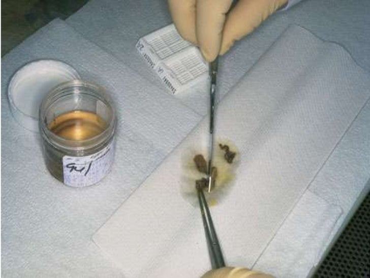 Fixatives used in histopathology