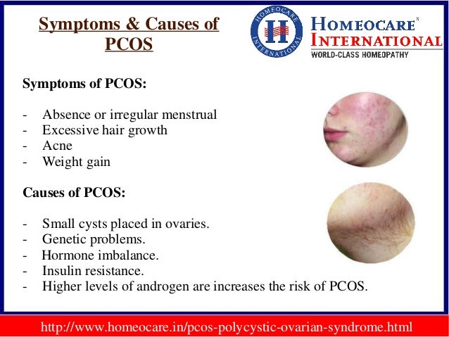 Ovarian cancer symptoms