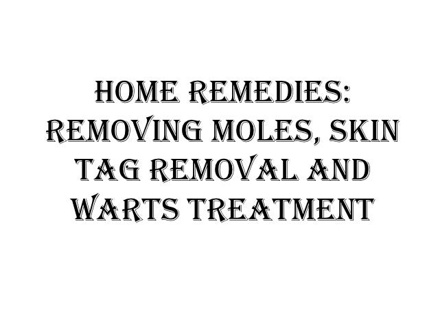 Home Remedies Reviews Removing Moles Skin Tag Removal And Warts Trea…