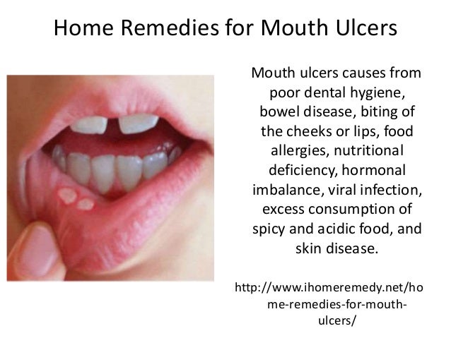 what cause mouth ulcers