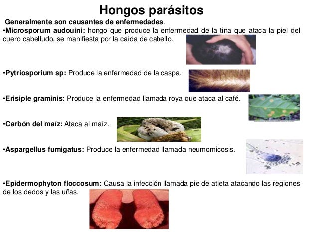 El hongo la casa de madera los medios públicos