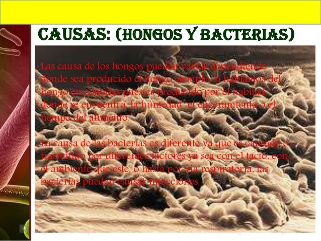 El hongo en los pies y su precio
