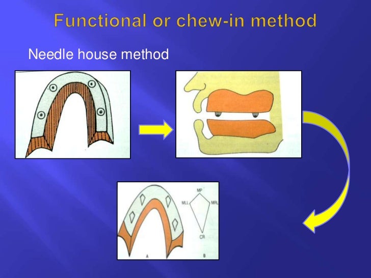 Horizontal jaw relations ppt