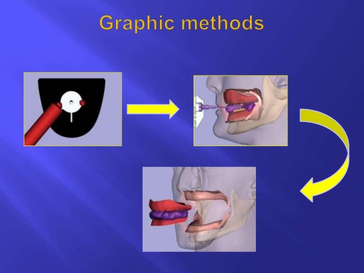 Horizontal jaw relations ppt