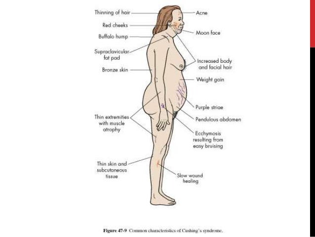 Deltasone Online Usa