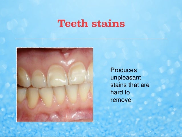 teeth gums loss