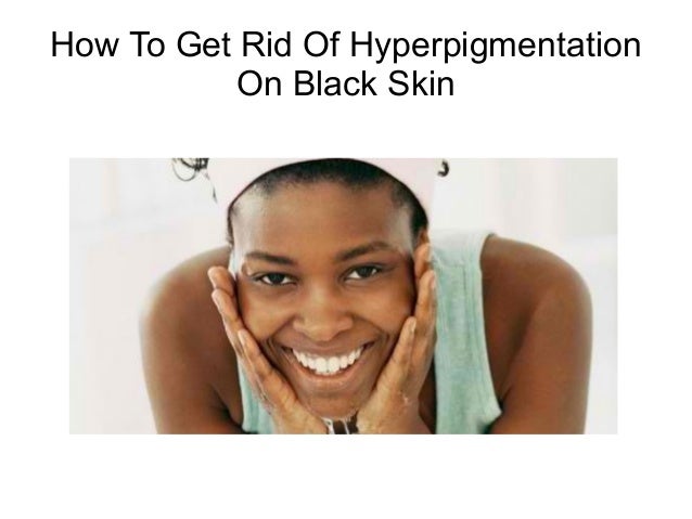 How To Get Rid Of Hyperpigmentation On Black Skin