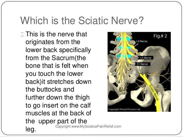 How to Get Rid of Pinched Sciatic Nerve Pain &amp; Get Relief From Sciati 