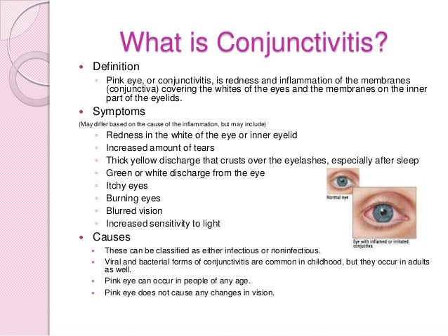 Ping Eye Home Remedies Ping Eye Home Remedies