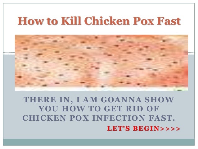 Chicken Pox