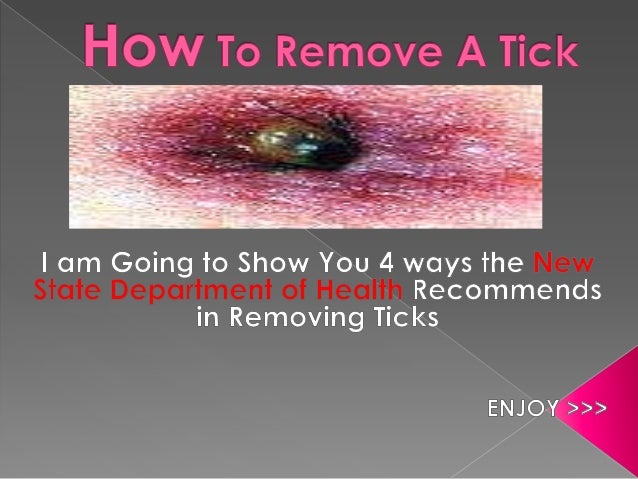 how to remove a tick from a with vaseline how to remove a tick fast how to remove a tick from a with vaseline how to remove a tick fast