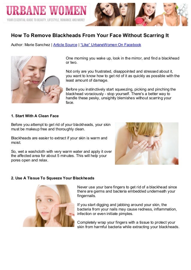 How To Remove Blackheads From Your Face Without Scarring It