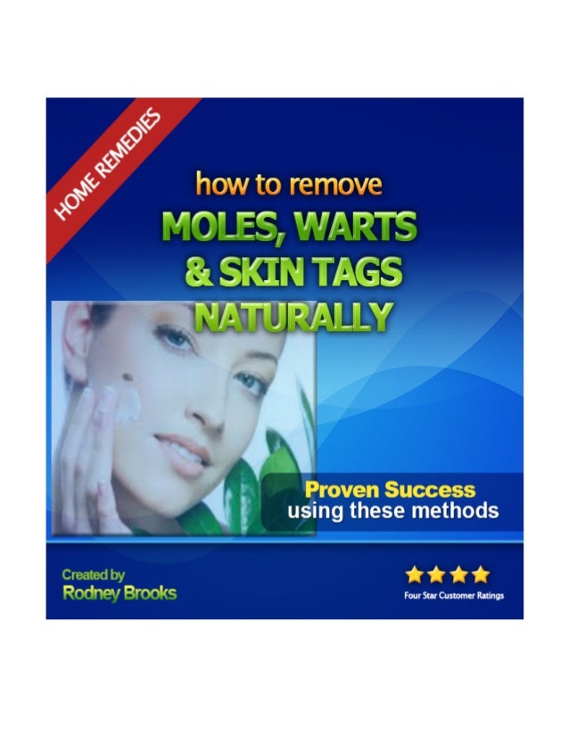 Naturally Remove Warts At Home Naturally Remove Warts At Home