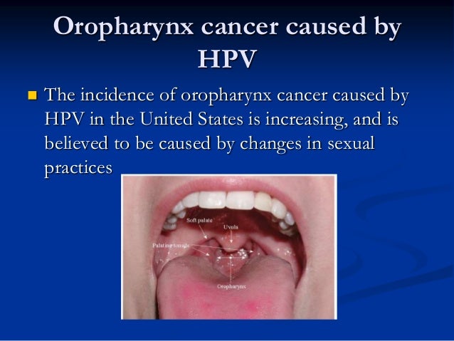 Information For The Patient On Human Papilloma Virus Hpv And Head A…