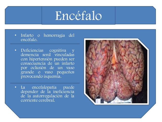 Codificar del alcoholismo para casa