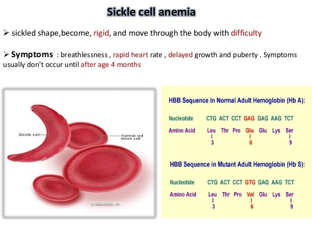 Is There a Heart Disease Gene advise Is There a Heart Disease Gene recommendations