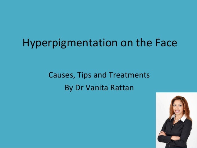 Hyperpigmentation on the face slide share