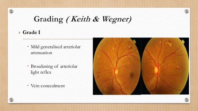 reflex-pupillary