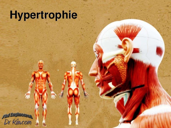Hypertrophie