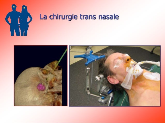 Quel membre trouve petit