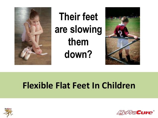 Acquired Flat Feet