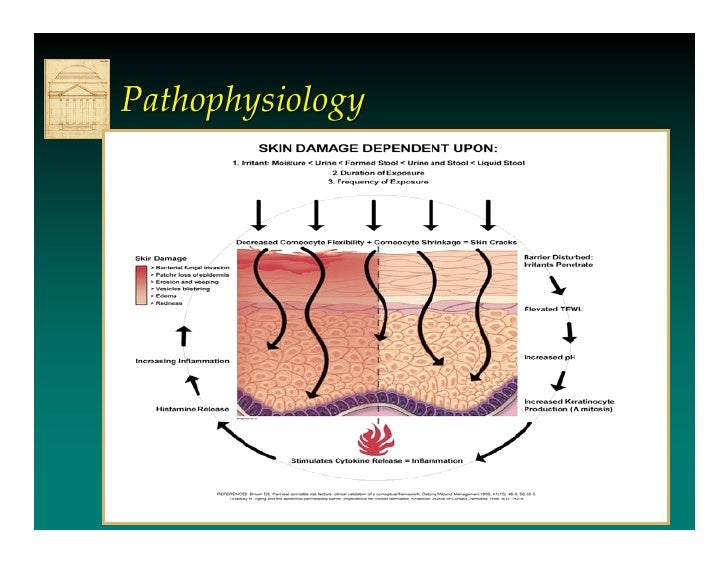 Incontinence Associated Dermatitis by Prof Dr Mikel Gray