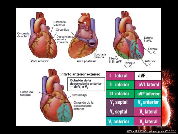 Acc aha 2008 guidelines for the management of adults with congenital heart