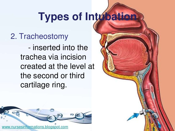 Neurological Assessment & Artificial Airway Management