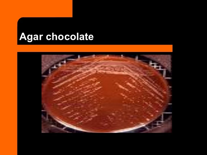 Identificación Bacteriana MICROBIOLOGIA