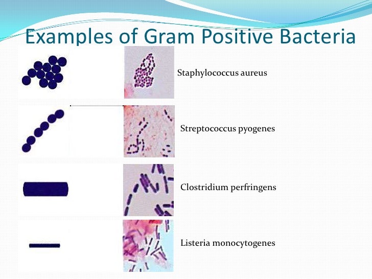 Gram Positive Cocci Identification Chart