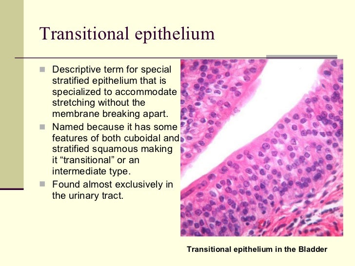 What type of epithelial tissue is found in the urinary bladder image