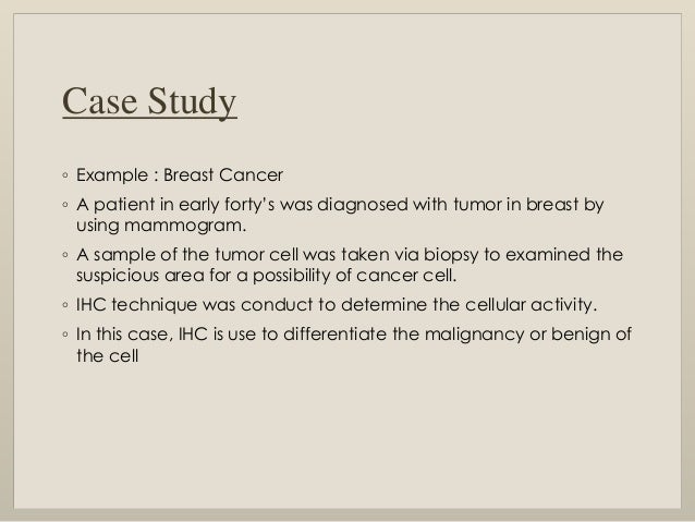 Case study cancer breast