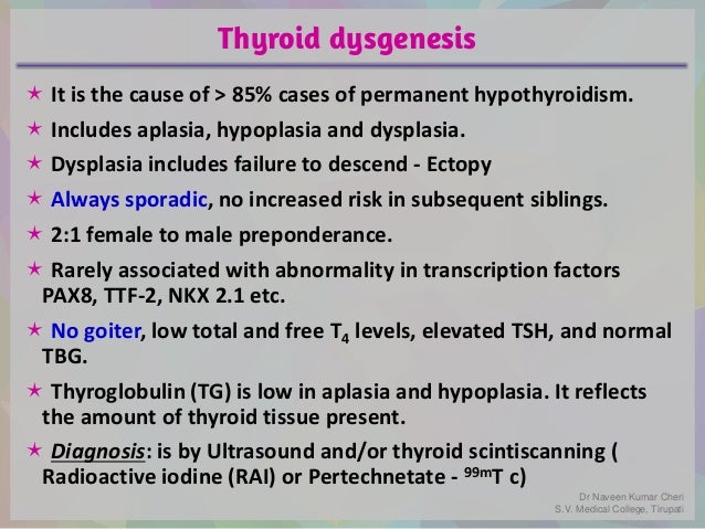Congenital Hypothyroidism