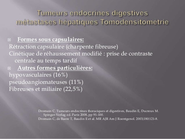 Metastase Kystique Foie