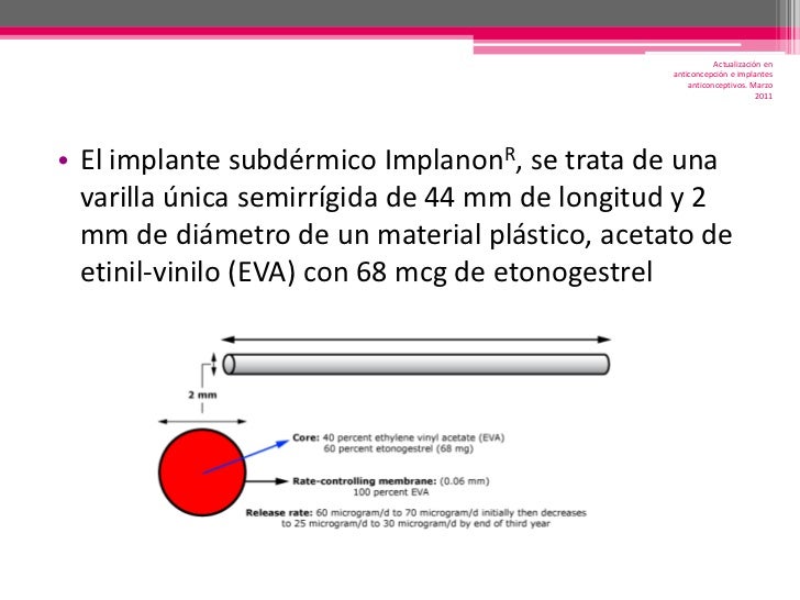 Implantes anticonceptivos Implantes anticonceptivos